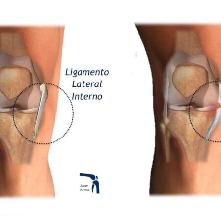 Grave Baja para el Barcelona: Marc Casadó sufre Rotura de Ligamento de Rodilla